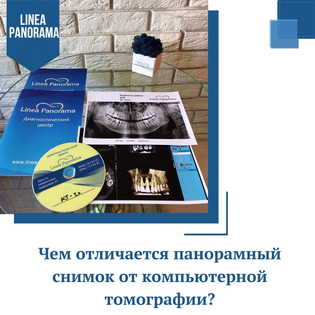В чём разница между компьютерной томографией и панорамным снимком?