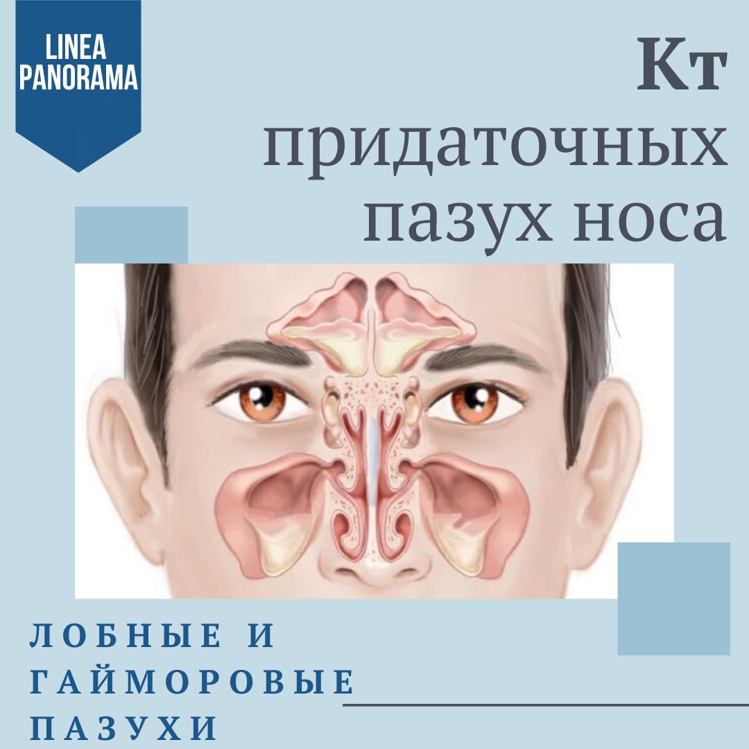 КТ придаточных пазух носа