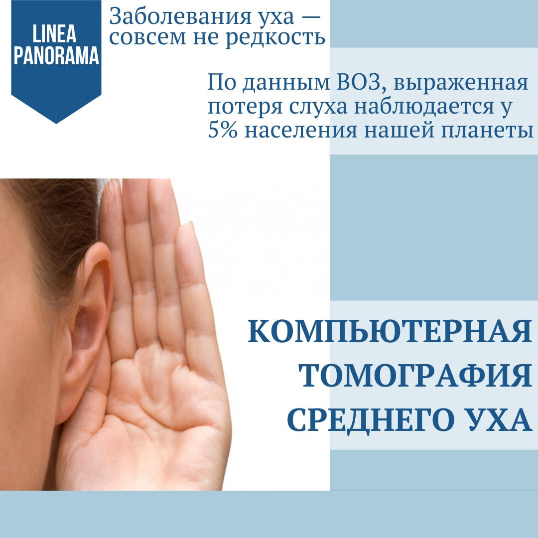 КТ среднего уха