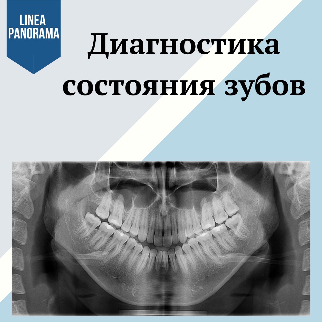 Диагностика состояния зубов