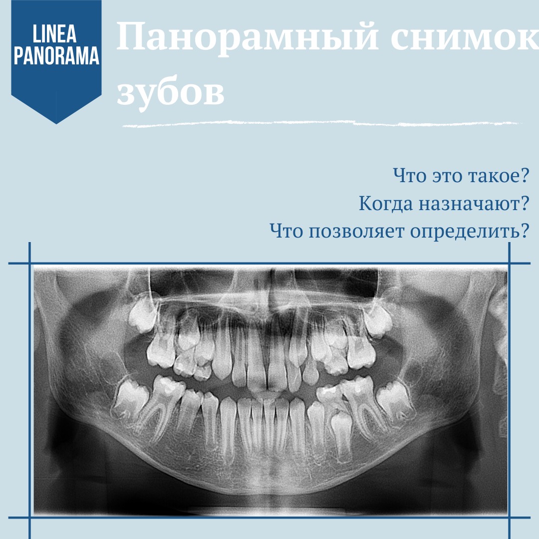 Панорамный снимок