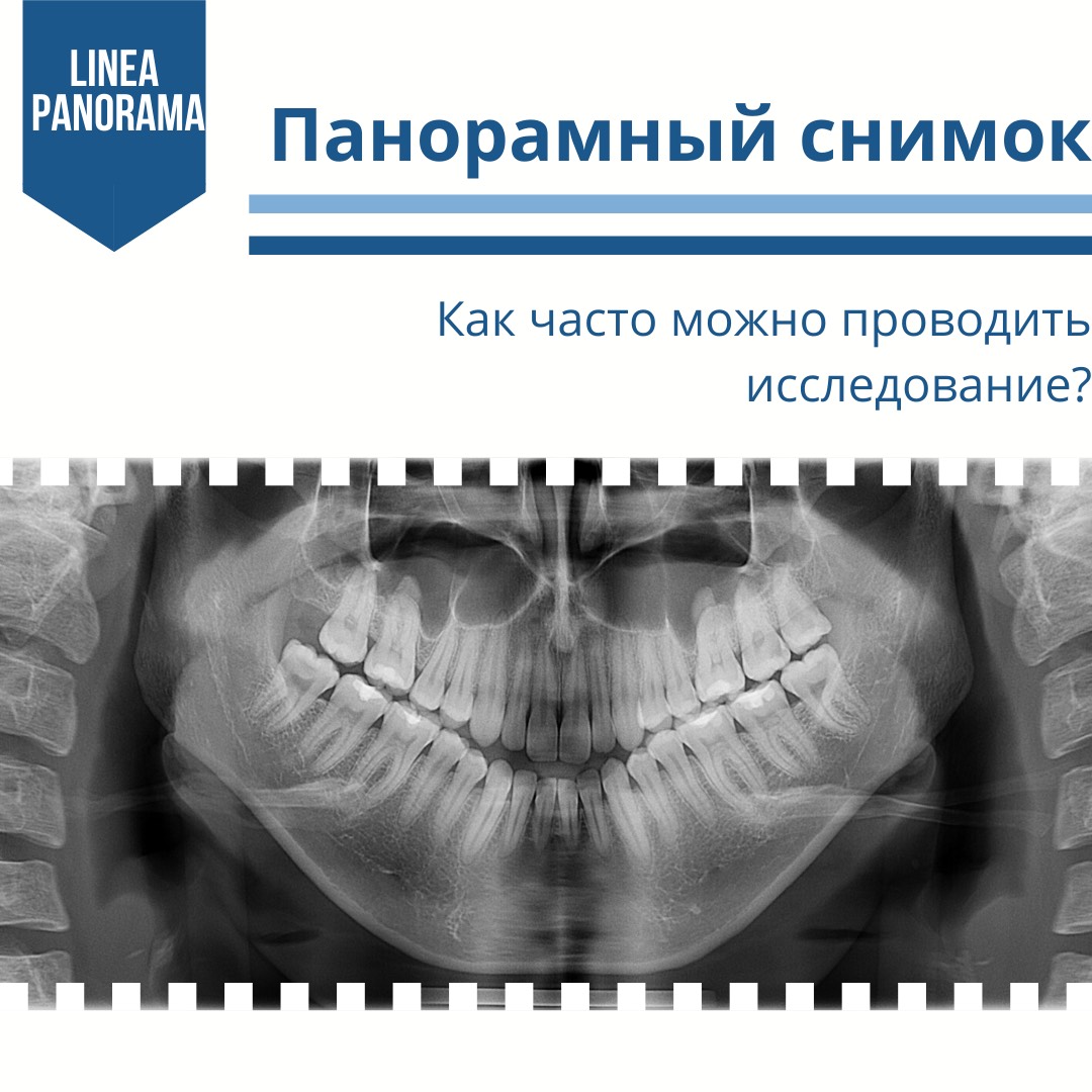 Как часто можно проводить панорамный снимок?