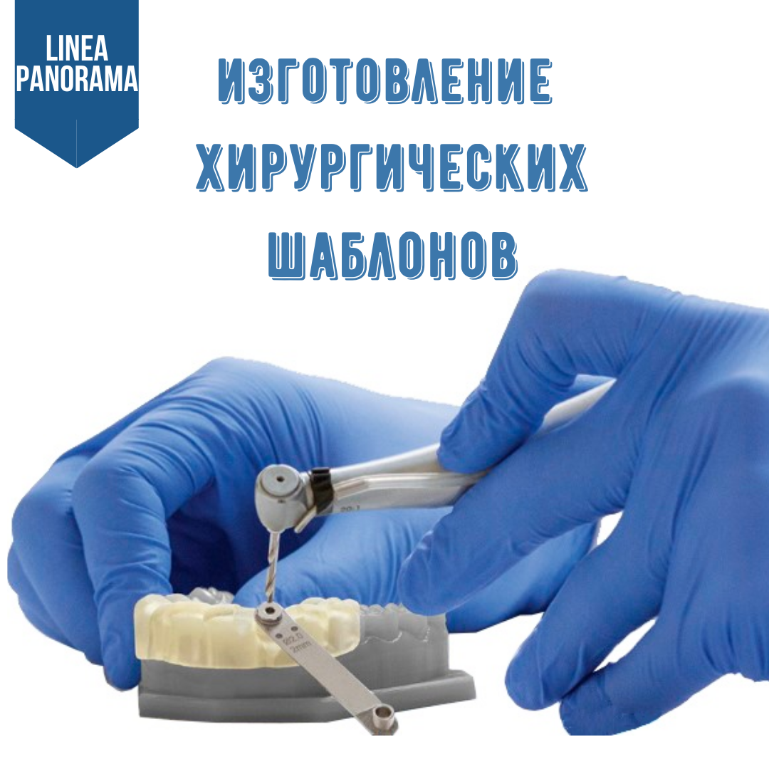 Хирургические шаблоны изготовление