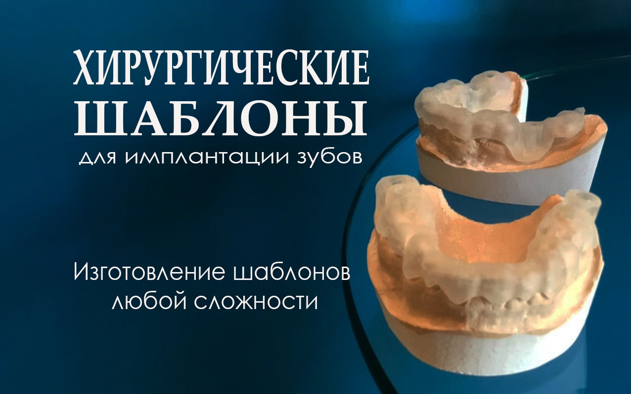 Изготовление индивидуальных шаблонов для имплантации